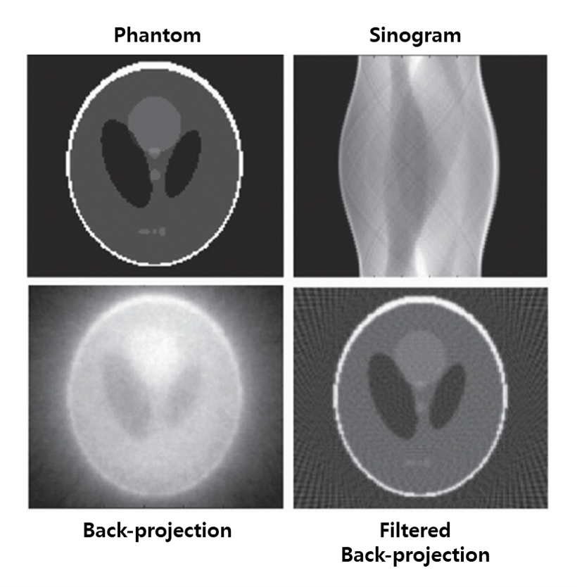 FBP of Phantom